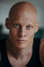 The Albino